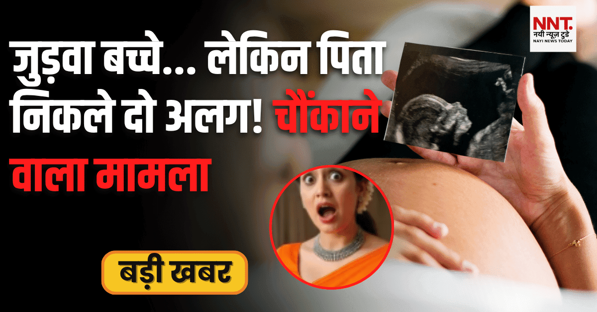 जुड़वा बच्चों का दुर्लभ मामला जिसमें पिता निकले दो अलग